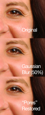 Chemical Peel (alphahydroxy acids(AHAs)–Glycolic acid)